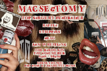 Macsectomy