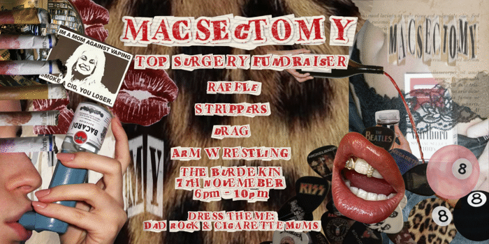 Macsectomy